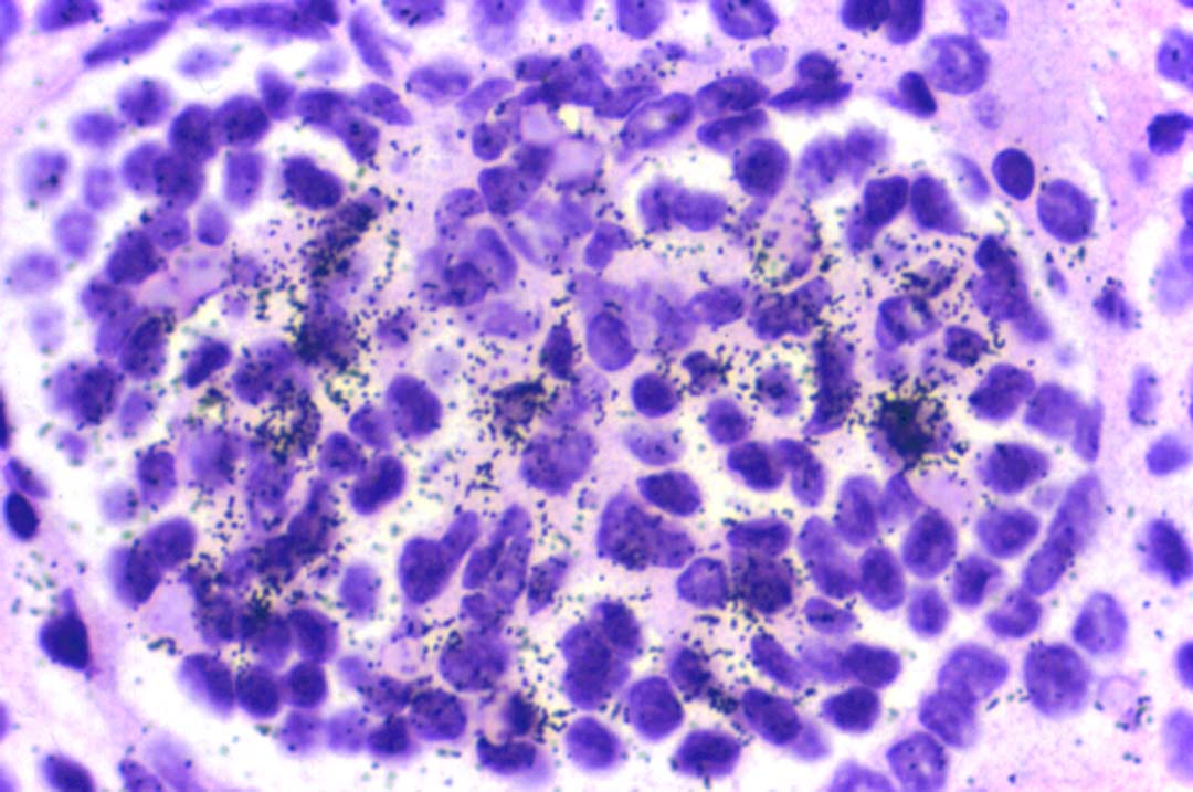 35S In situ hybridization 